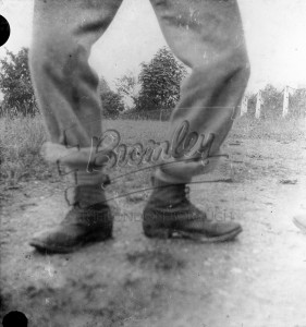 Man with bow legs,  undated
